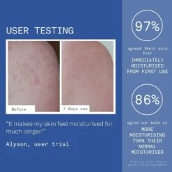 Ultra Caring Body Balm For Dry, Sensitive & Eczema-Prone Skin 250ml -Outlet Soft Touch Care Store ultra caring body balm for dry sensitive eczema prone skin 250ml p31145 84207 image